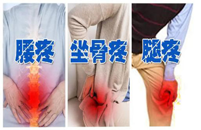 腰椎間盤突出坐姿、睡姿、日常鍛煉、最好治療方法