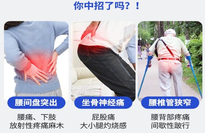 長期壓迫神經腰疼怎么治療